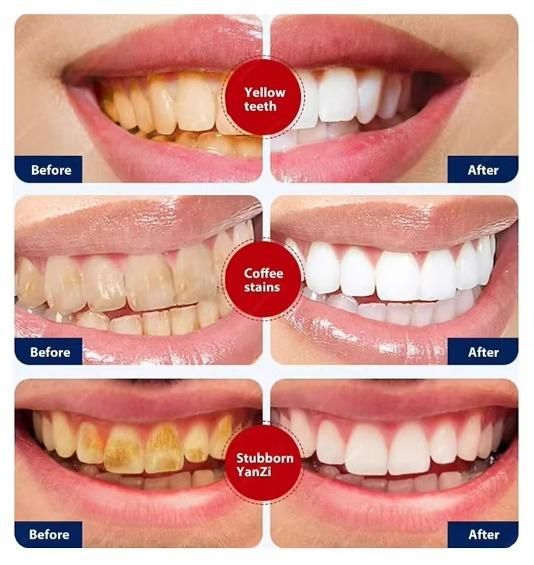 Smoke Stains White Plus Toothpaste