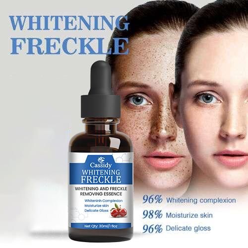 Cassidy Freckle Clear Serum