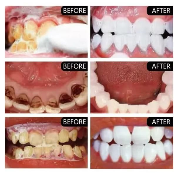 Smoke Stains White Plus Toothpaste